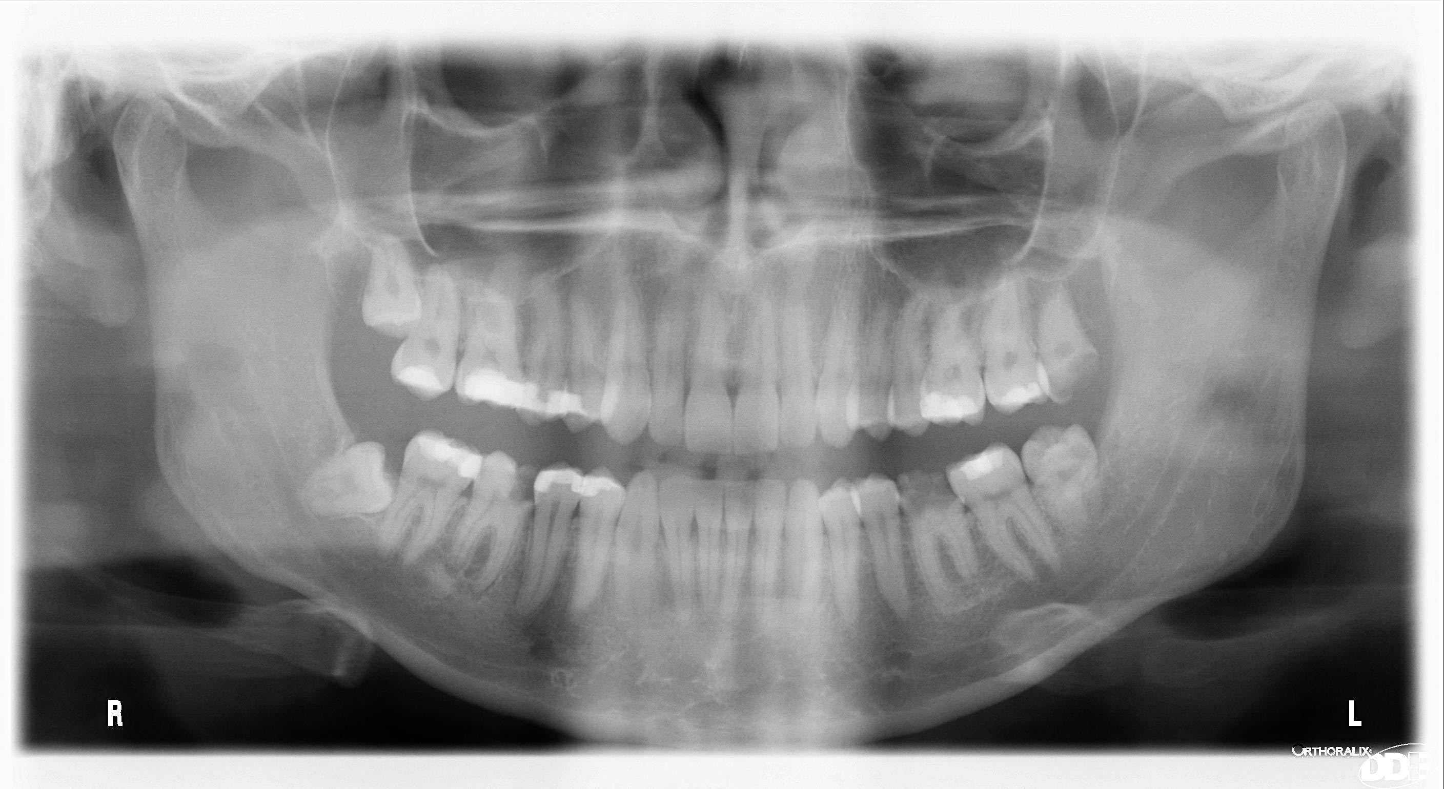 tooth digital dentistry burlington