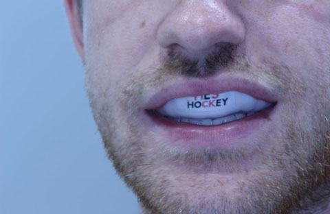 Mouthguards-Hockey-Burlington