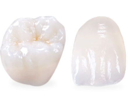 Ceramic-Dental-Crown