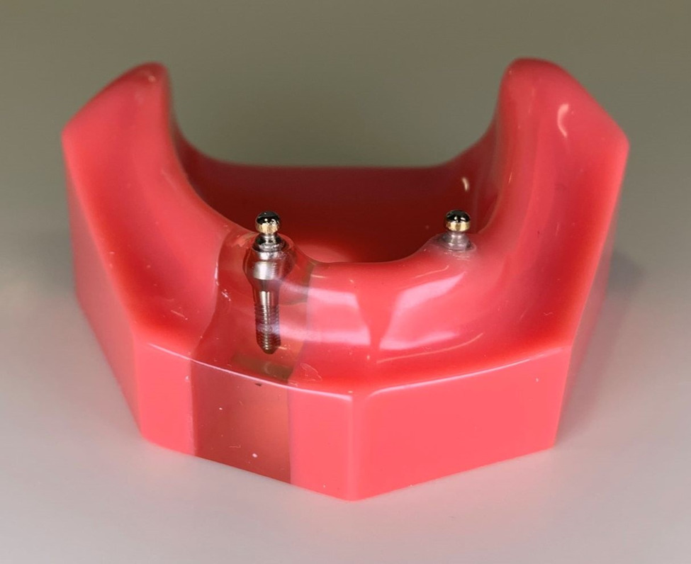 Affinity Dental Care - Mini Implants