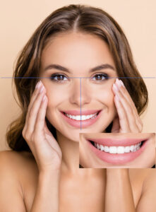 Perfect Smile | Affinity Dental Care Burlington